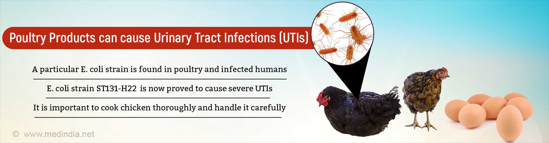 e-coli-from-infected-poultry-can-cause-urinary-tract-infection