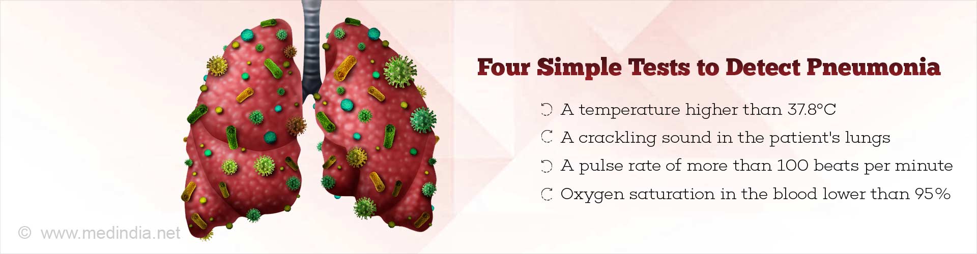 Spot Pneumonia With Four Simple Tests: A Guide For Doctors