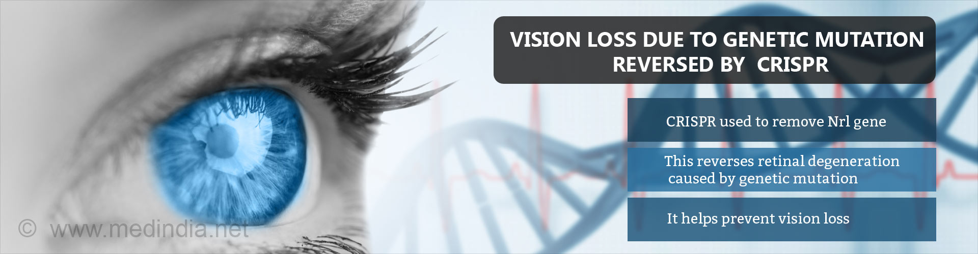 Crispr Used To Modify Vision Loss Caused By Genetic Mutation