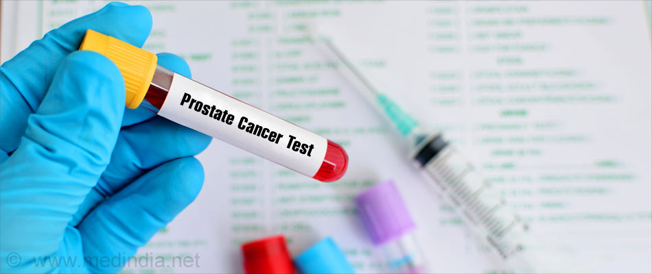 blood test for prostate cancer