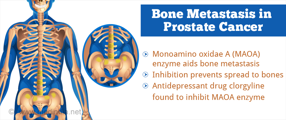 ‘Old’ Drug Used for ‘New’ Method of Preventing Bone