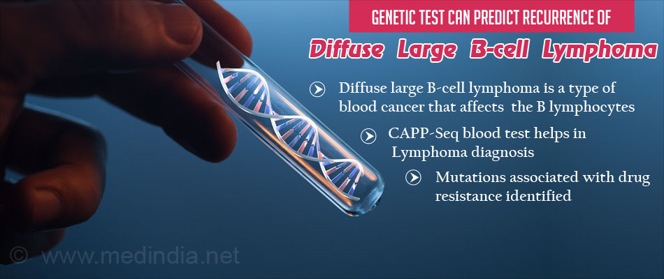 Simple Blood Test To Monitor Patients With Diffuse Large B-cell Lymphoma