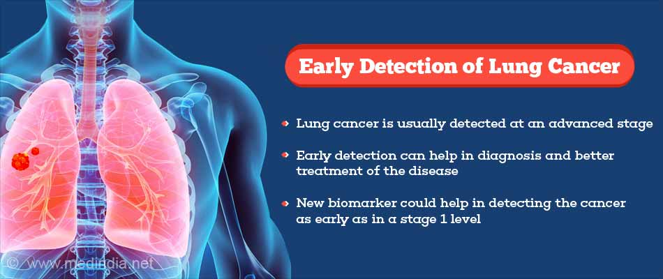 Early Detection of Lung Cancer Possible With Newly Identified Biomarker