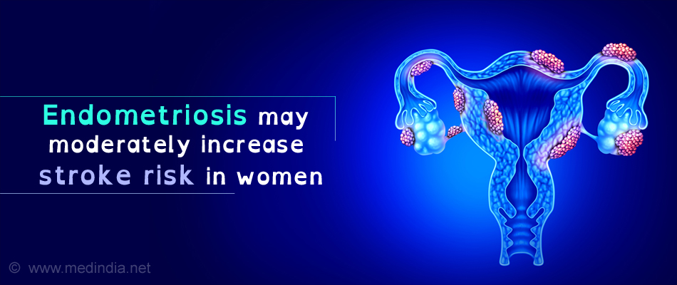 Endometriosis: Causes, Symptoms, Diagnosis, Treatment