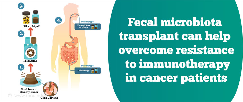 Fecal Microbiota Transplant Helps Treat Cancer Resistant To Immunotherapy