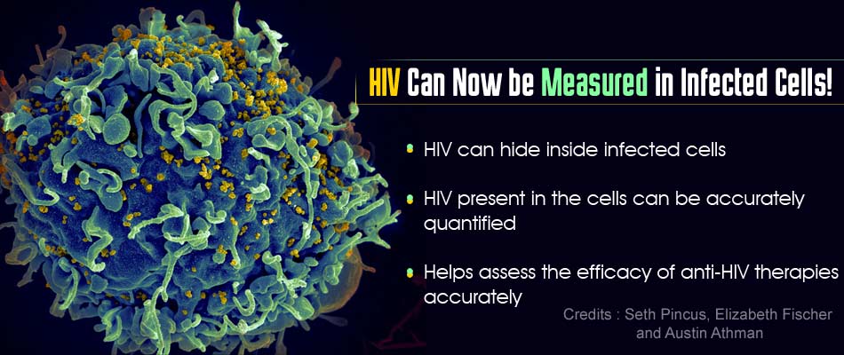 Hiv Hiding Inside Patients Cells Can Now Be Measured Accurately