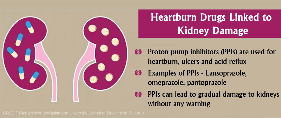 Commonly Used Heartburn Drugs Can Lead to Gradual Yet ‘Silent’ Kidney ...