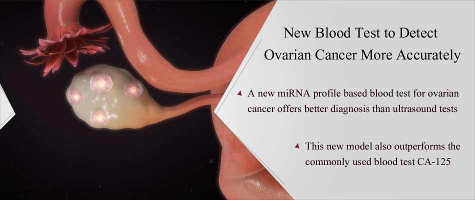 New Blood Test to Detect Ovarian Cancer More Accurately