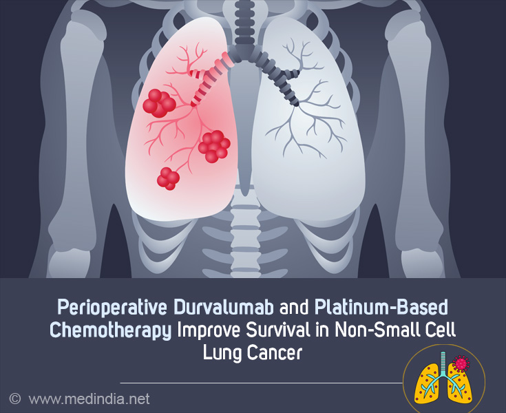 Perioperative Immunotherapy: A Promising Approach for Resectable Lung ...