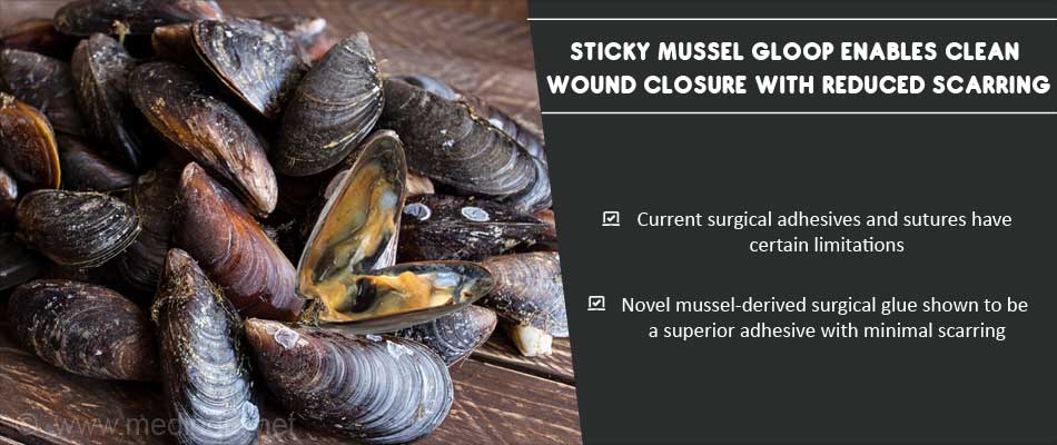Mussel-inspired surgical glue shuts down bleeding wounds in 60 seconds