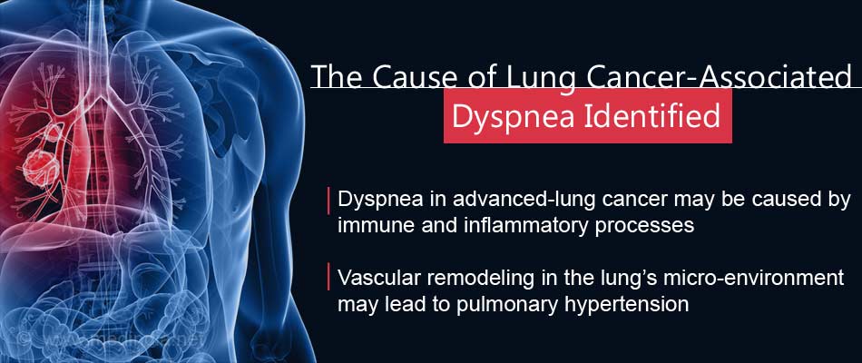 The Cause of Lung Cancer-Associated Dyspnea Identified