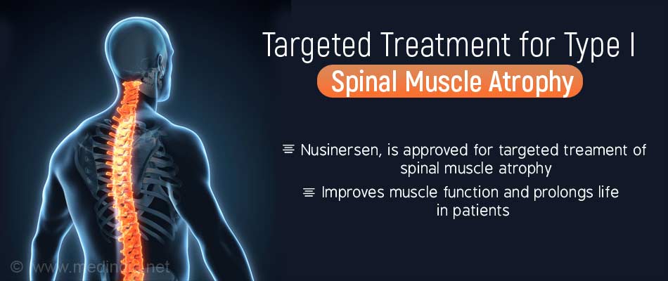 Nusinersen Shows Benefit In Type I Spinal Muscle Atrophy