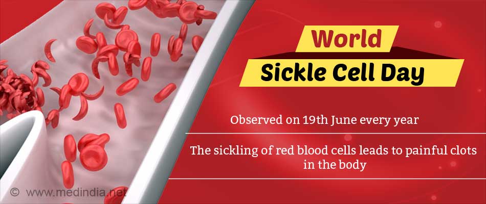 World Sickle Cell Day