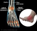 New Anatomic Structure in the Ankle Joint Identified