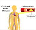 Soft or Hard Plaque - Which Poses Greater Risk of Heart Attack?