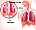 New Breathing Exercise Helps Athletes Manage Breathing Disorder