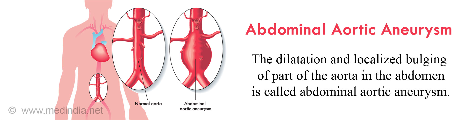 Aorta oh слив фото