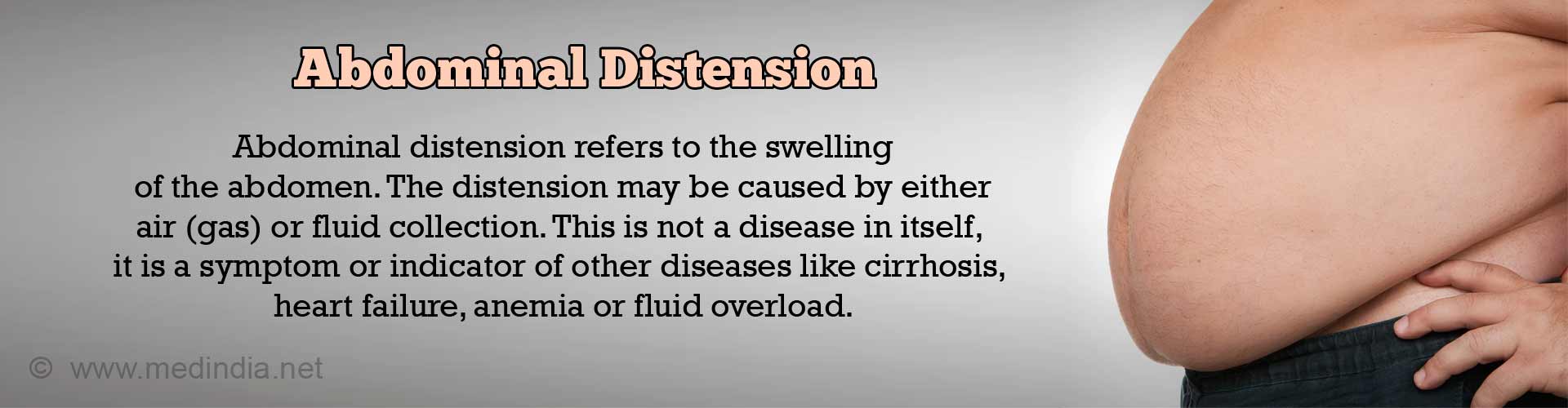 abdominal-distension-causes-symptoms-diagnosis-treatment