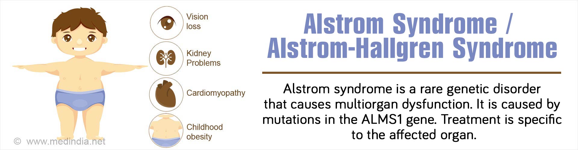 Alström Syndrome Alström Hallgren Syndrome Causes Symptoms Diagnosis Treatment And Prognosis