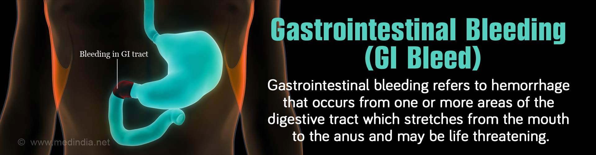 gastrointestinal-bleeding-gi-bleed-causes-symptoms-and-signs