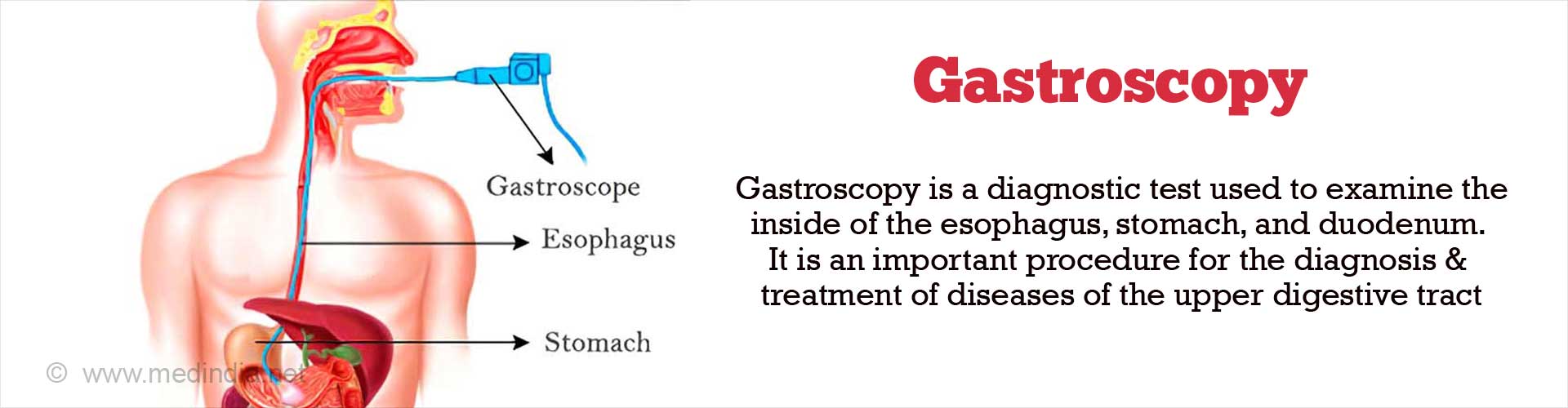 gastroscopy-indication-contraindication-performance-complications