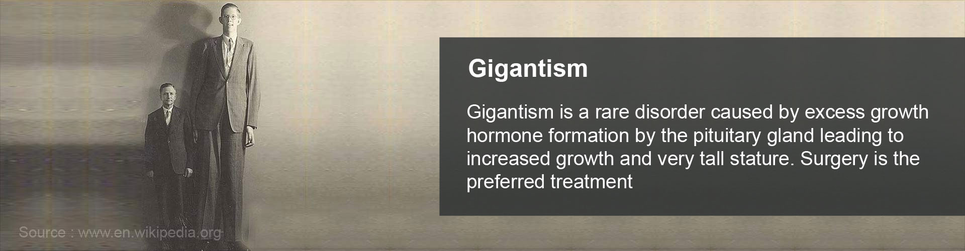 gigantism-causes-signs-symptoms-diagnosis-and-treatment