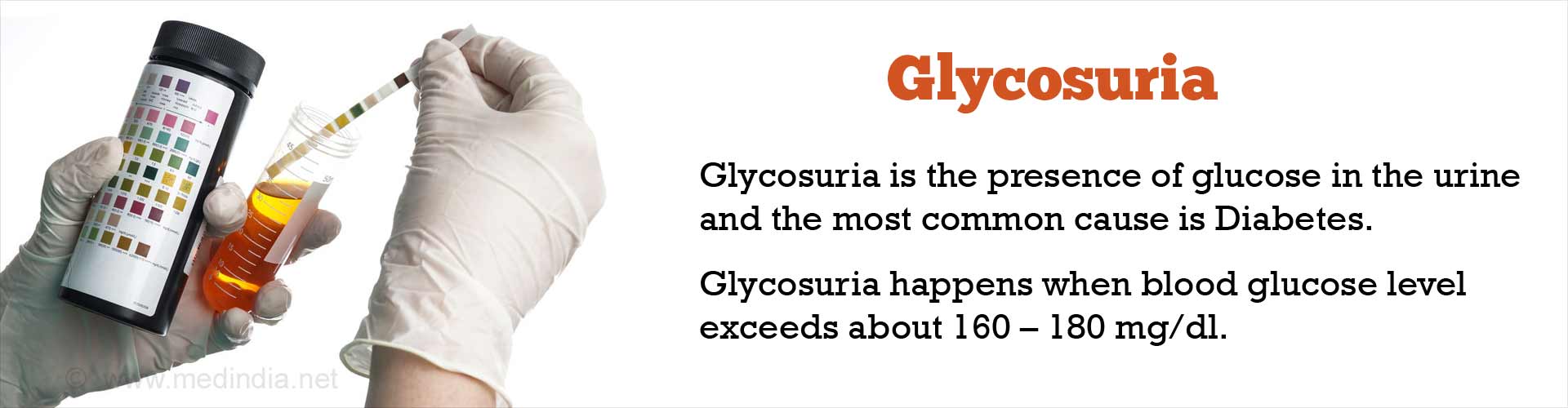 is glycosuria a symptom of diabetes