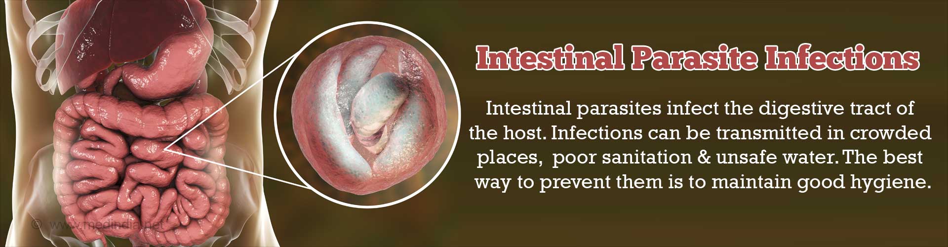 types of intestinal infections        <h3 class=