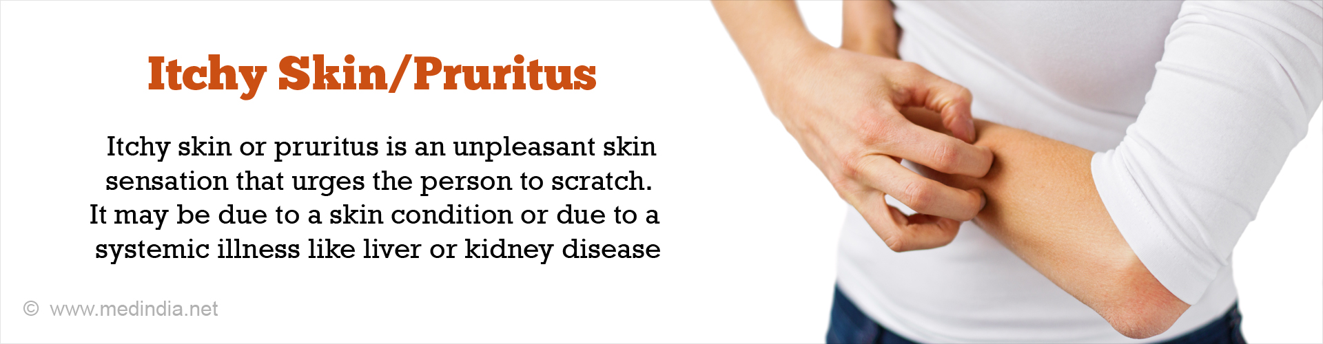 Itchy Skin Pruritus – Causes Symptoms Diagnosis Treatment