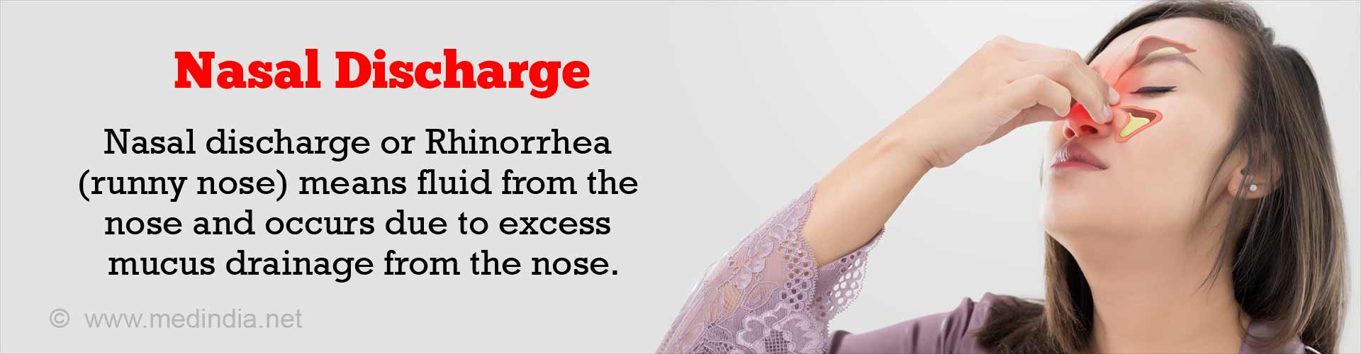 What Is Nasal Discharge