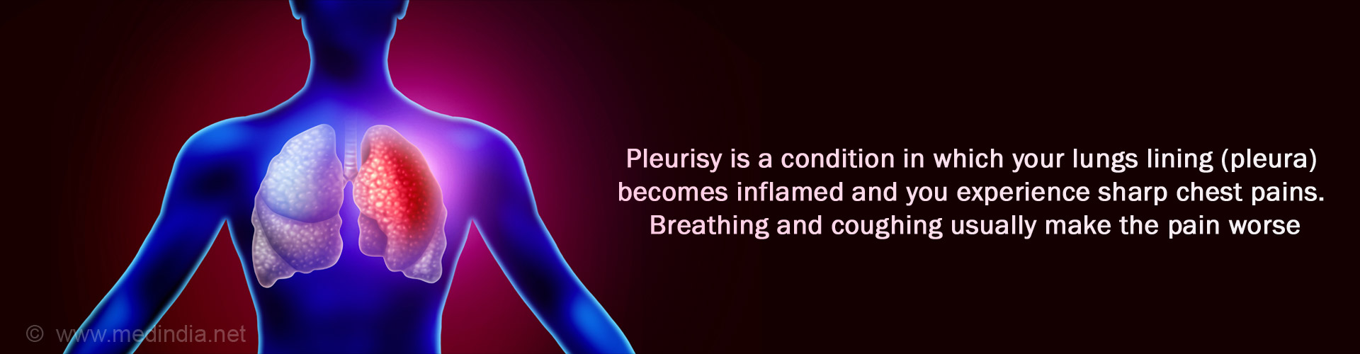 Pleurisy - Causes, Symptoms, Diagnosis, Treatment