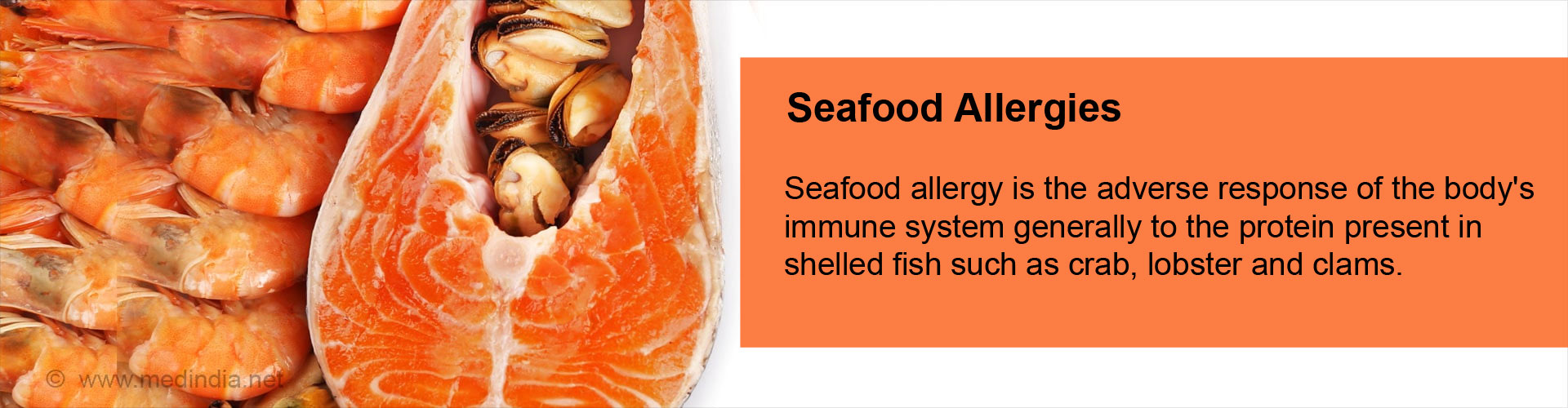 Seafood Allergies - Symptoms, Diagnosis & Treatment