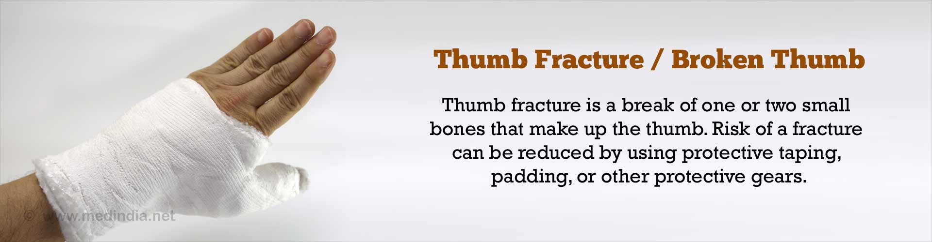 thumb-fractures-broken-thumb-causes-symptoms-diagnosis-treatment