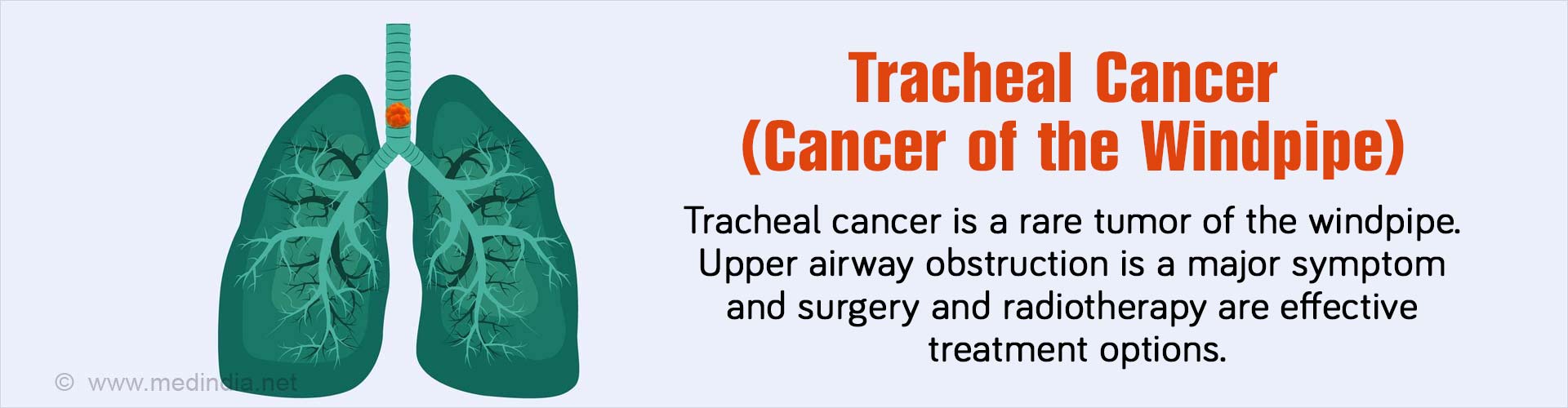 Tracheal Cancer Cancer Of The Windpipe Causes Symptoms Diagnosis