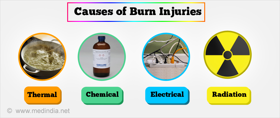 Pain Management for Burn Injuries