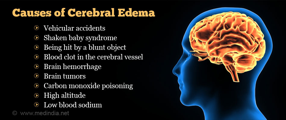 Cerebral Edema Causes Symptoms Diagnosis Treatment Prevention