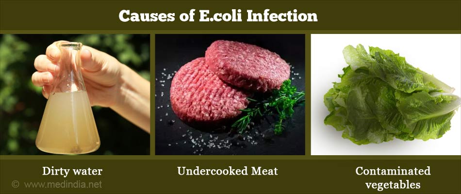 E Coli Infection Escherichia Coli Infection Causes Diagnosis   Causes Of E Coli Infection 