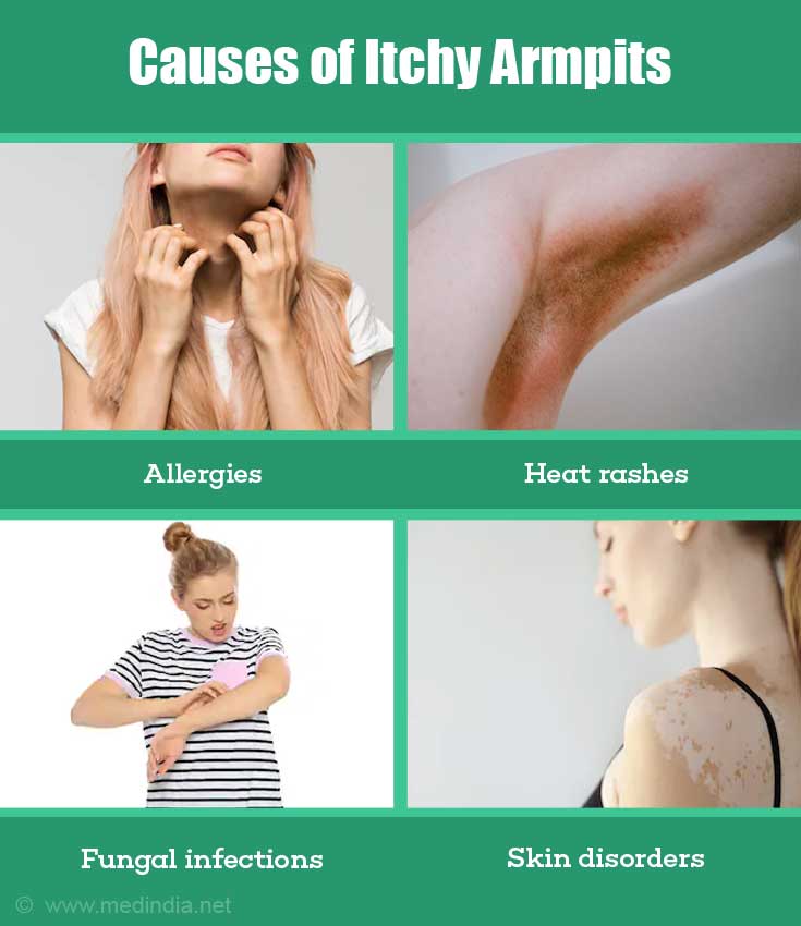 itchy-armpits-causes-prevention-and-treatment