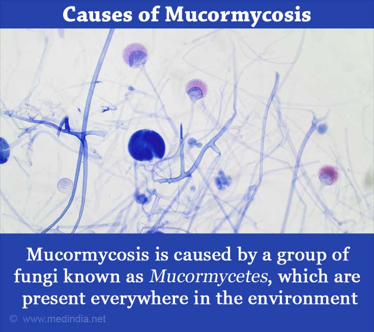 Causes of Mucormycosis