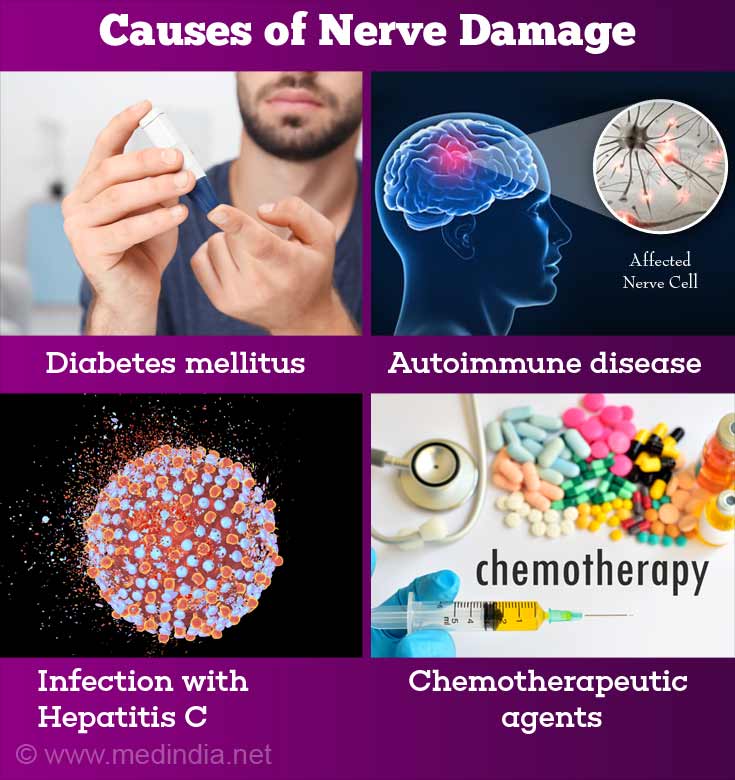 11 Alarming Symptoms & Signs You Should Look Out For Nerve ...