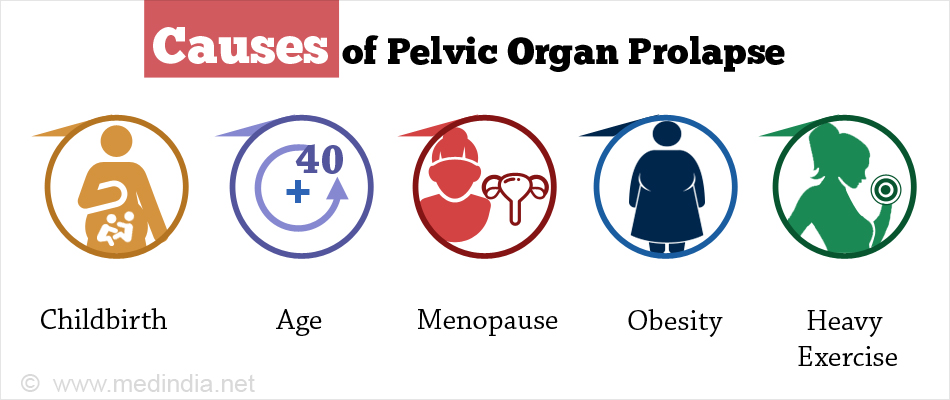 pelvic-organ-prolapse-types-causes-symptoms-diagnosis-treatment