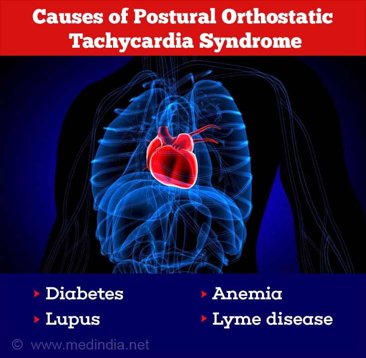 Postural Orthostatic Tachycardia Syndrome (POTS) - Causes, Symptoms ...