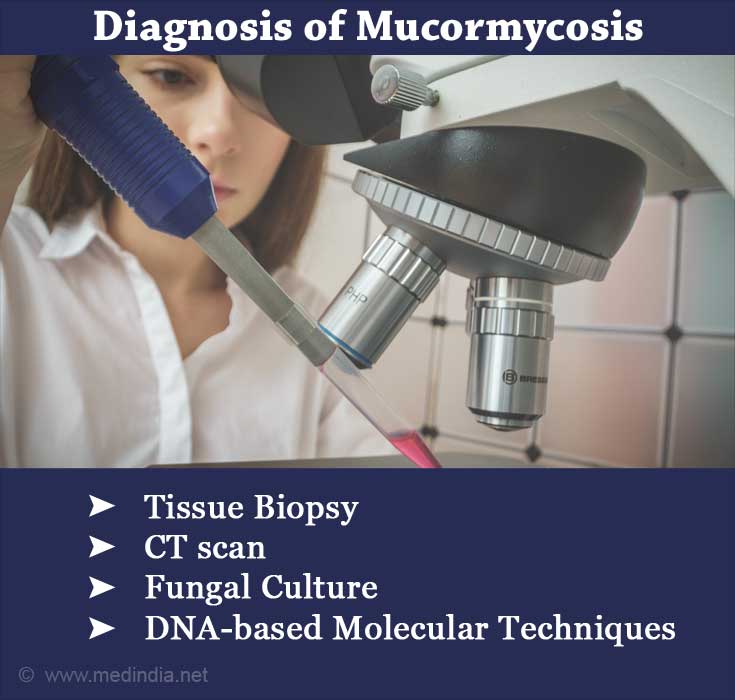 Diagnosis of Mucormycosis