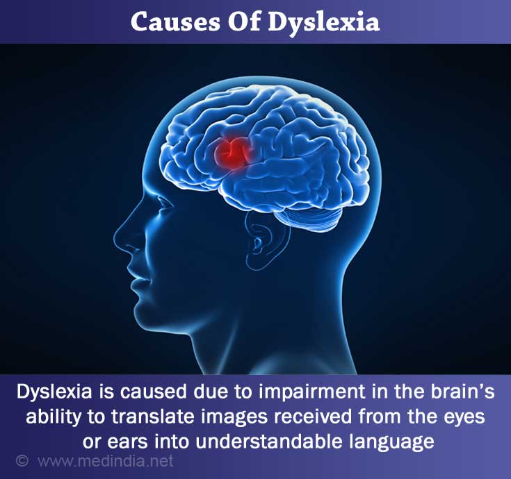 Dyslexia Causes