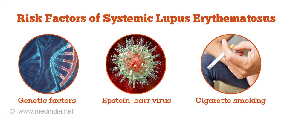 Systemic Lupus Erythematosus Sle Causes Symptoms Diagnosis And Treatment 6527