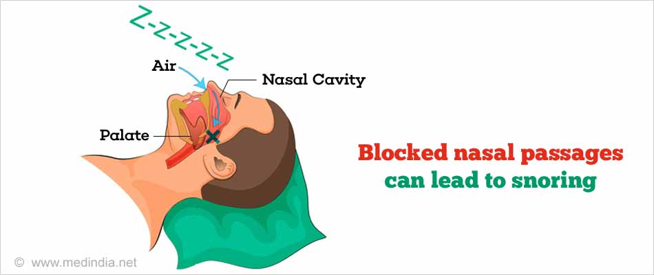 Simple, Top Ways to Stop Snoring - Causes - Ways to Stop