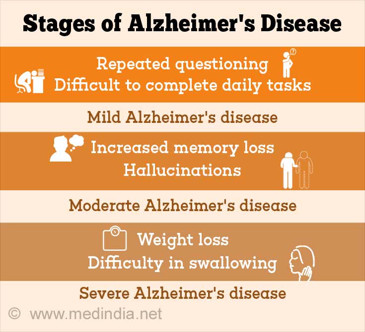 Alzheimer S Stages