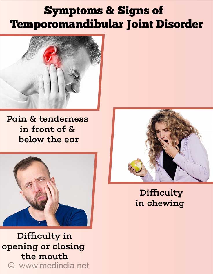 Temporomandibular Joint Disorders - Causes, Symptoms, Diagnosis & Treatment