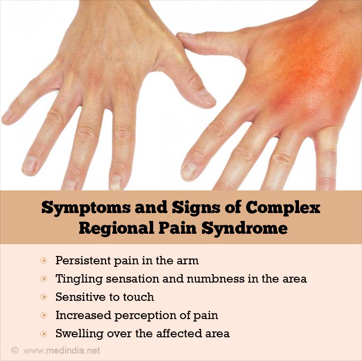 types-and-symptoms-of-complex-regional-pain-syndrome