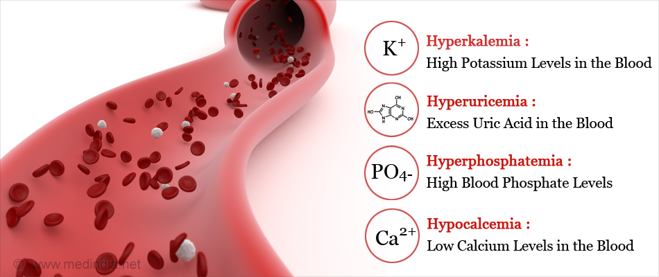 Tumor Lysis Syndrome - Risk Factors, Symptoms, Diagnosis & Treatment